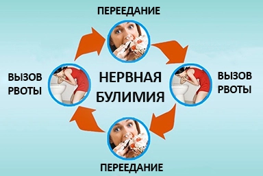 Лечение булимии в Елизово